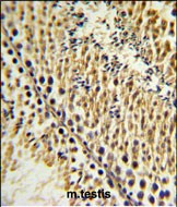 EXTL3 Antibody in Immunohistochemistry (Paraffin) (IHC (P))