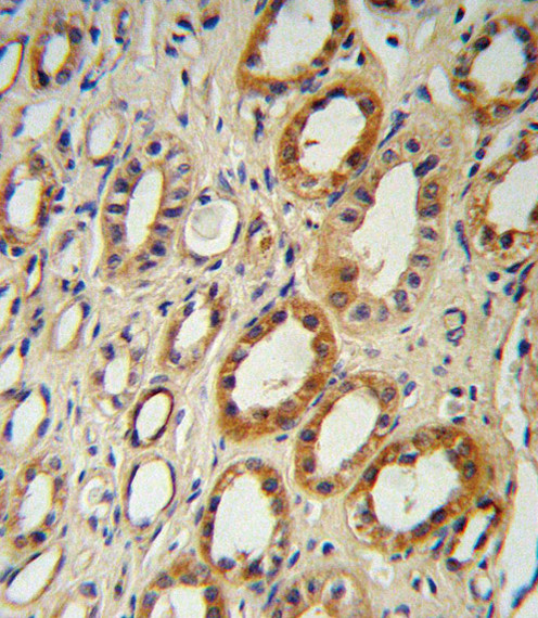 CYP27B1 Antibody in Immunohistochemistry (Paraffin) (IHC (P))