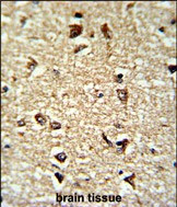 Cdc2L6 Antibody in Immunohistochemistry (Paraffin) (IHC (P))