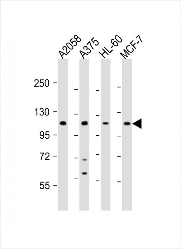 COL17A1 Antibody in Western Blot (WB)