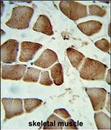 DIPA Antibody in Immunohistochemistry (Paraffin) (IHC (P))