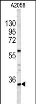 HOXA9 Antibody in Western Blot (WB)