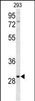 CLRN3 Antibody in Western Blot (WB)