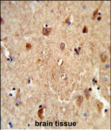 CES7 Antibody in Immunohistochemistry (Paraffin) (IHC (P))