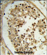 ELOVL2 Antibody in Immunohistochemistry (Paraffin) (IHC (P))