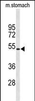 Kir6.2 (KCNJ11) Antibody in Western Blot (WB)