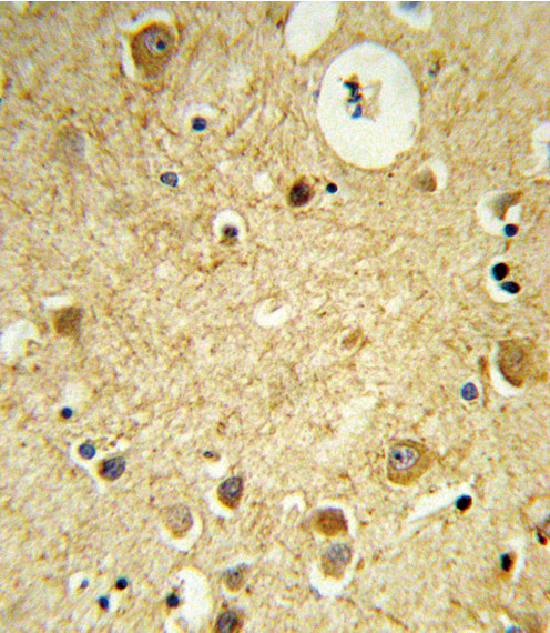 RECK Antibody in Immunohistochemistry (Paraffin) (IHC (P))
