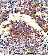 C7 Antibody in Immunohistochemistry (Paraffin) (IHC (P))