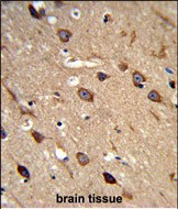 ASIC1 Antibody in Immunohistochemistry (Paraffin) (IHC (P))