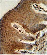 PTMS Antibody in Immunohistochemistry (Paraffin) (IHC (P))