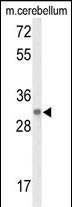 DAGLB Antibody in Western Blot (WB)