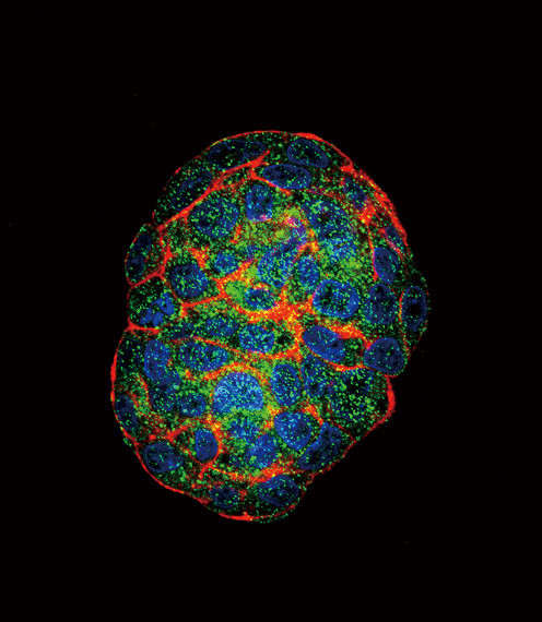 GBE1 Antibody in Immunocytochemistry (ICC/IF)