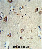 HS3ST2 Antibody in Immunohistochemistry (Paraffin) (IHC (P))