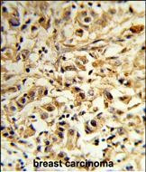 MAT2B Antibody in Immunohistochemistry (Paraffin) (IHC (P))