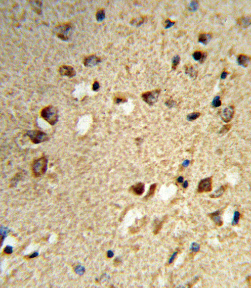 NCOA7 Antibody in Immunohistochemistry (Paraffin) (IHC (P))