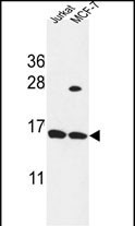 SPRR1A Antibody in Western Blot (WB)