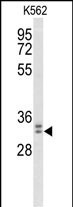 MORG1 Antibody in Western Blot (WB)