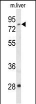 ACSS2 Antibody in Western Blot (WB)