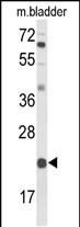DGCR6 Antibody in Western Blot (WB)