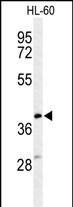 MT-CYB Antibody in Western Blot (WB)