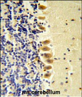 STK40 Antibody in Immunohistochemistry (Paraffin) (IHC (P))