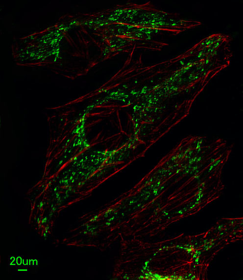 SLC25A37 Antibody in Immunocytochemistry (ICC/IF)