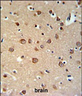 PDE6C Antibody in Immunohistochemistry (Paraffin) (IHC (P))