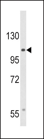 CACNA2D3 Antibody in Western Blot (WB)