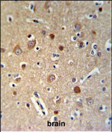 HSPA12A Antibody in Immunohistochemistry (Paraffin) (IHC (P))
