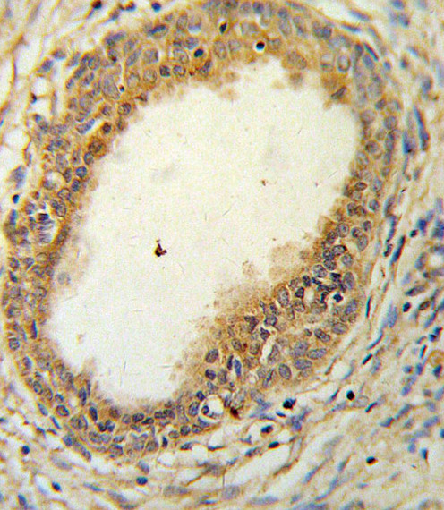 HAPLN1 Antibody in Immunohistochemistry (Paraffin) (IHC (P))