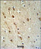 ZRANB1 Antibody in Immunohistochemistry (Paraffin) (IHC (P))
