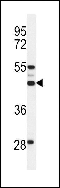 SLC51A Antibody in Western Blot (WB)