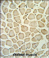 PGP Antibody in Immunohistochemistry (Paraffin) (IHC (P))