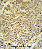 GSTK1 Antibody in Immunohistochemistry (Paraffin) (IHC (P))