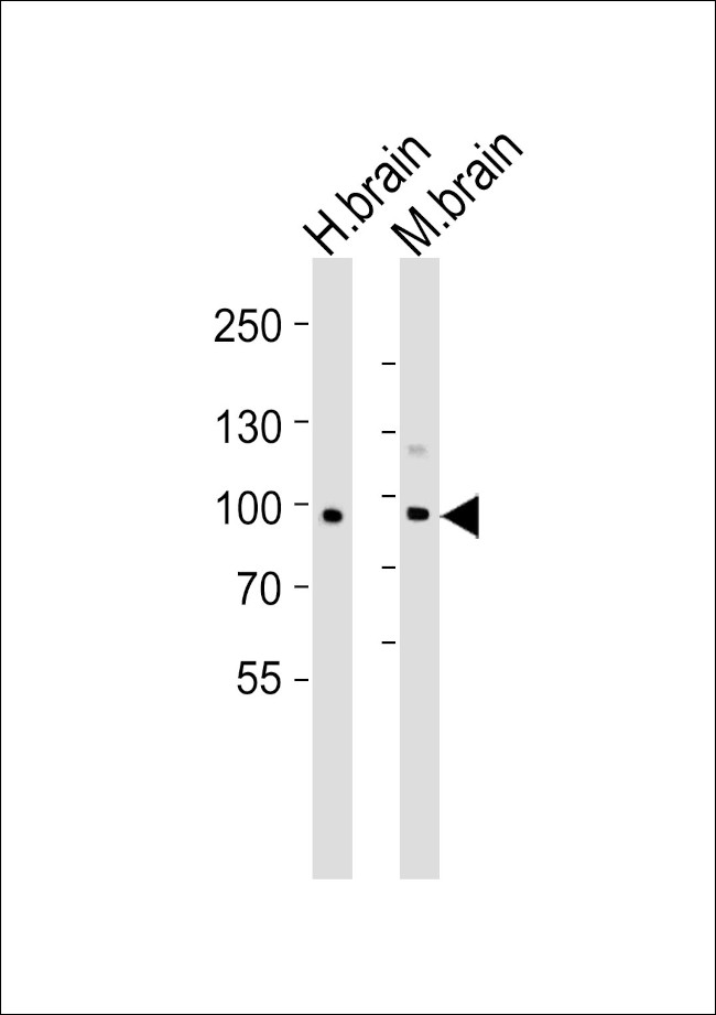 CDH20 Antibody in Western Blot (WB)