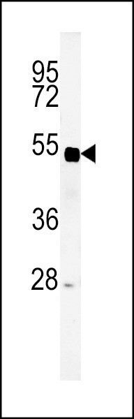 SP5 Antibody in Western Blot (WB)