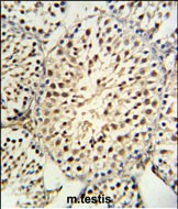 YPEL5 Antibody in Immunohistochemistry (Paraffin) (IHC (P))