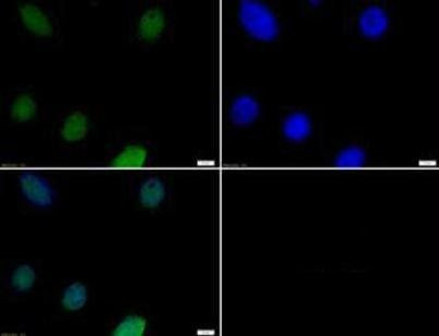 H3K4me2 Antibody in Immunocytochemistry (ICC/IF)