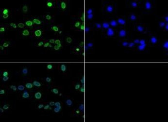 H3K4ac Antibody in Immunocytochemistry (ICC/IF)