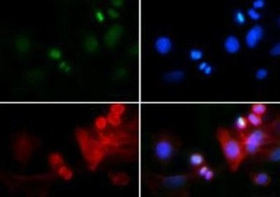 H3K4me3T6ph Antibody in Immunocytochemistry (ICC/IF)