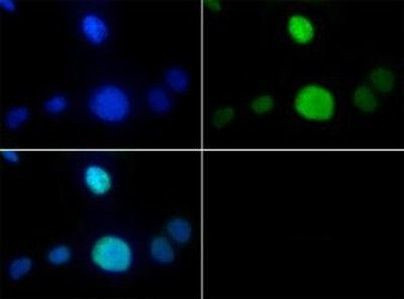 H3K9me1T6ph Antibody in Immunocytochemistry (ICC/IF)