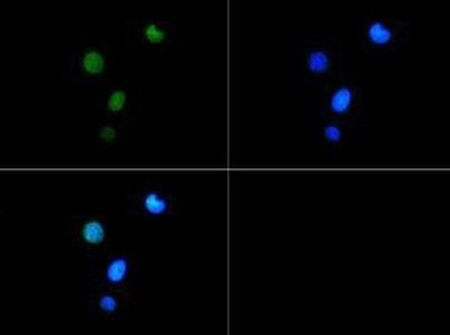 H3K9me3T6ph Antibody in Immunocytochemistry (ICC/IF)