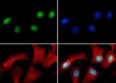 H3R8me2a Antibody in Immunocytochemistry (ICC/IF)