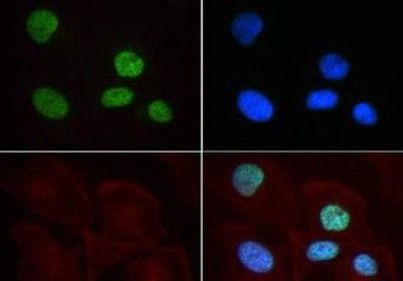 H3K9me2 Antibody in Immunocytochemistry (ICC/IF)