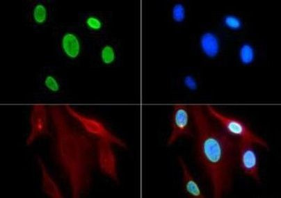 H3K9ac Antibody in Immunocytochemistry (ICC/IF)