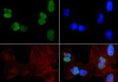 H3K9acK14ac Antibody in Immunocytochemistry (ICC/IF)
