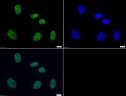 Phospho-Histone H3 (Ser10, Thr11) Antibody in Immunocytochemistry (ICC/IF)