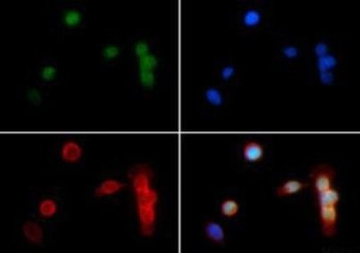 H3K18me2 Antibody in Immunocytochemistry (ICC/IF)