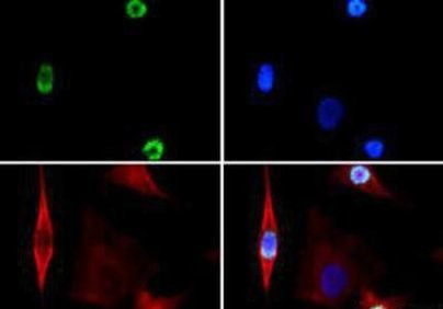 Phospho-Histone H3 (Ser28) Antibody in Immunocytochemistry (ICC/IF)