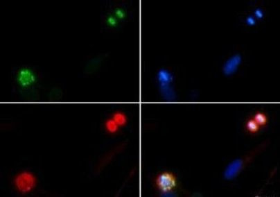 Phospho-Histone H4 (Ser1) Antibody in Immunocytochemistry (ICC/IF)